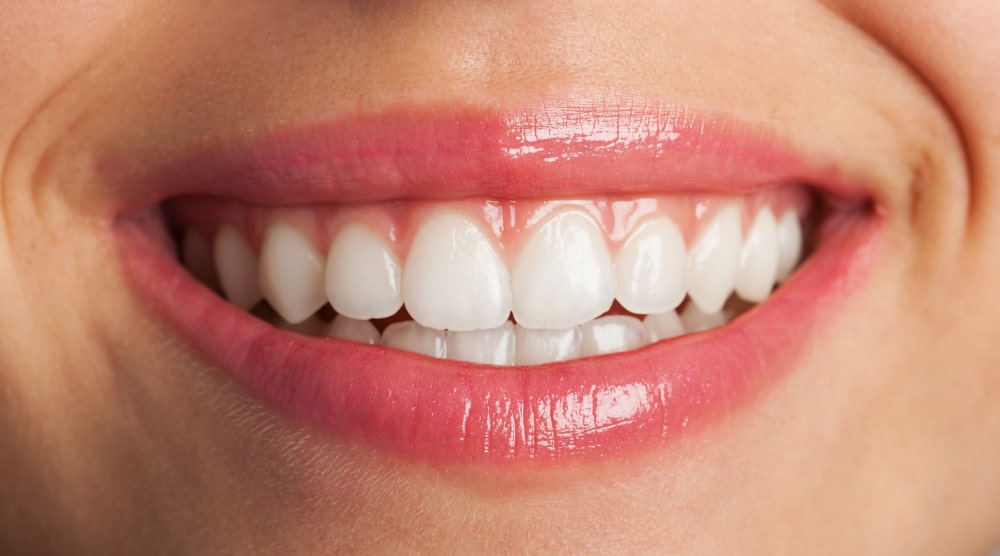 From Coffee Stains to Yellow Teeth: The Ultimate Guide to Teeth Whitening