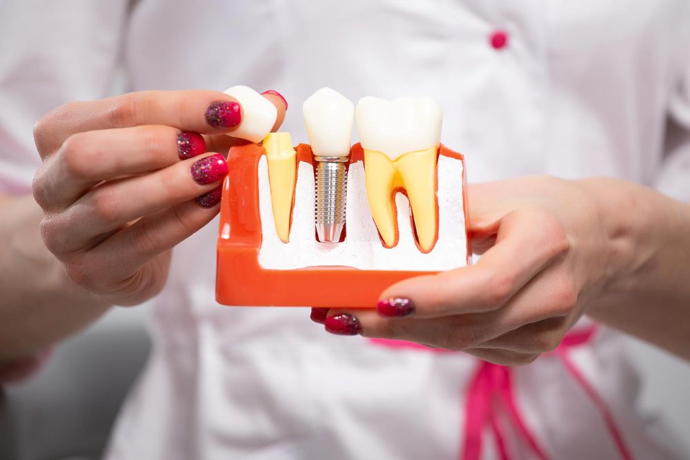 Young dentist doctor shows mock teeth with implant